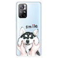 IMD Xiaomi Redmi Note 11 Pro/Note 11 Pro+ TPU-Skal - Smile